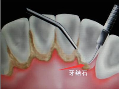 http://www.rmcbs.cn/d/file/price/1339145197.jpg