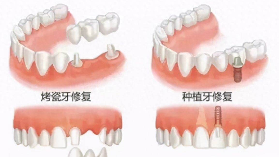 http://www.rmcbs.cn/d/file/price/1nafcone9zqt.jpg