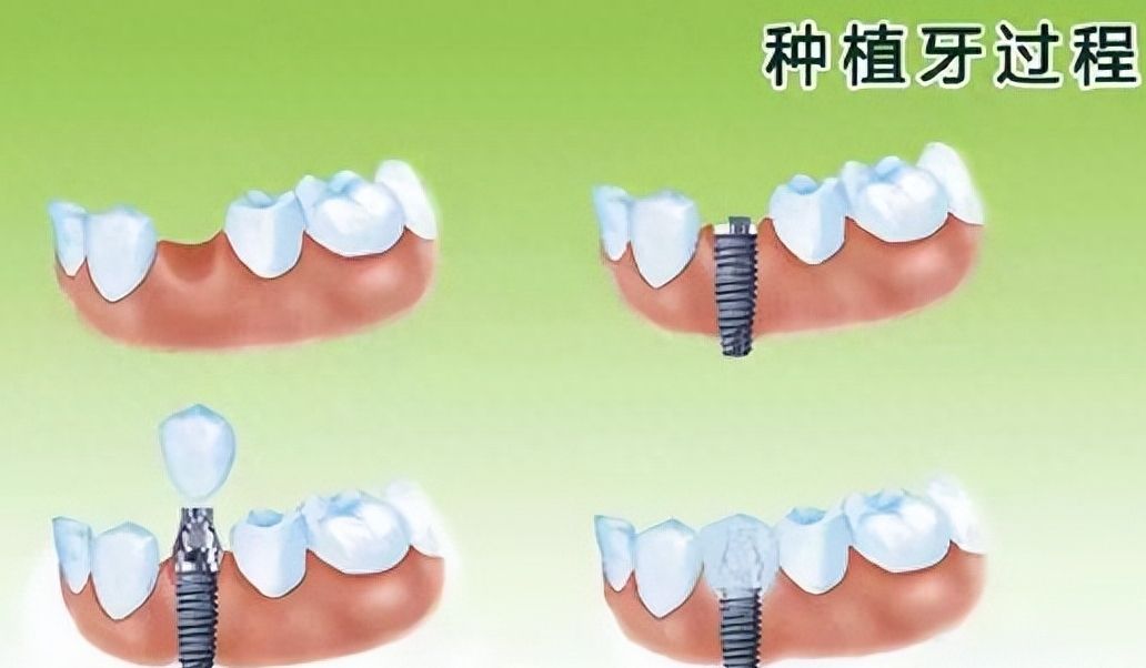 http://www.rmcbs.cn/d/file/price/205et0e9uhkt.jpg