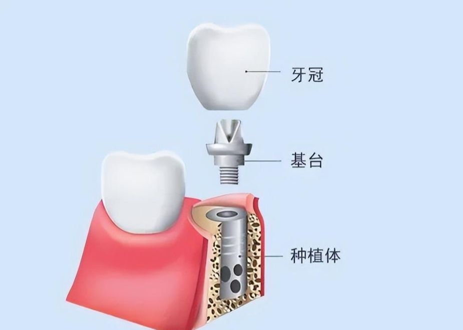 http://www.rmcbs.cn/d/file/price/28omksizedqr.jpg