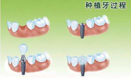 http://www.rmcbs.cn/d/file/price/2c74zh2oid8g.jpg