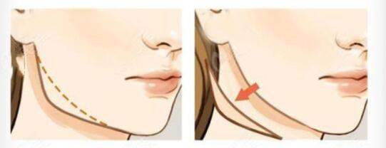 http://www.rmcbs.cn/d/file/price/310tbn1jqyxi.jpg