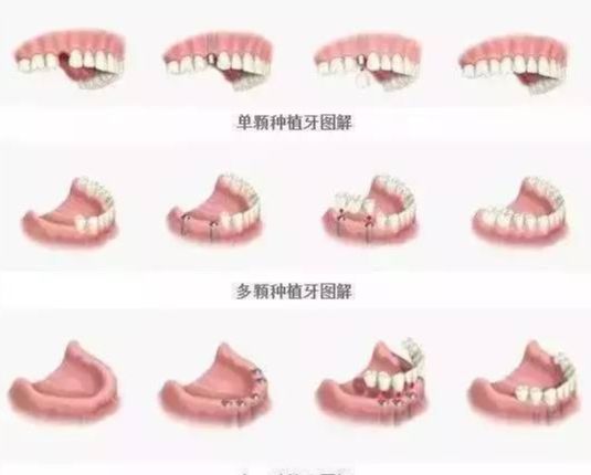 http://www.rmcbs.cn/d/file/price/4v82m4lly32p.jpg