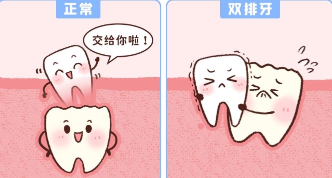 蚌埠三院牙齒矯正費(fèi)用全揭秘：透明標(biāo)價(jià)，品質(zhì)服務(wù)