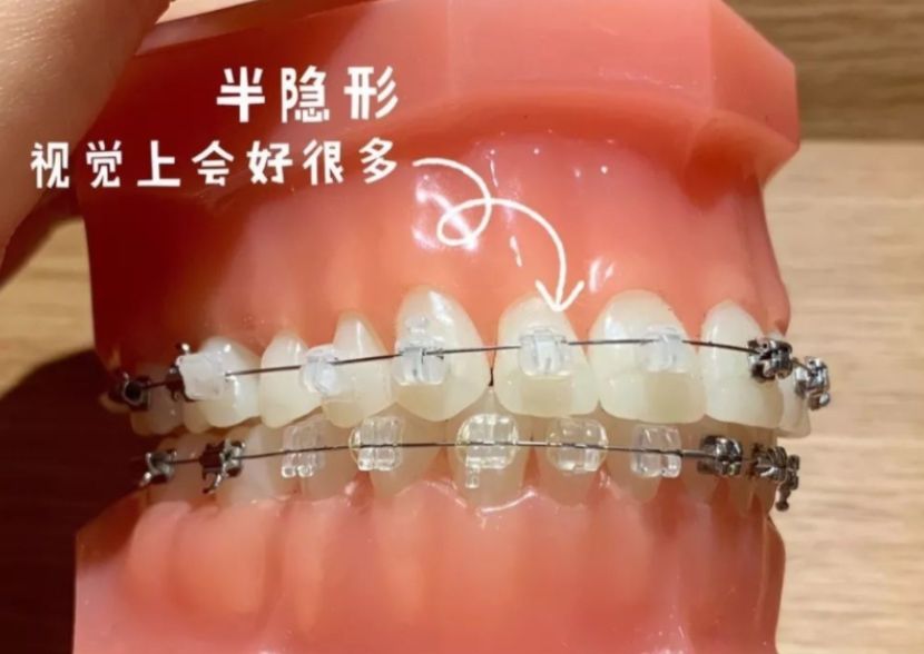 http://www.rmcbs.cn/d/file/price/6fl7es2blbjk.jpg