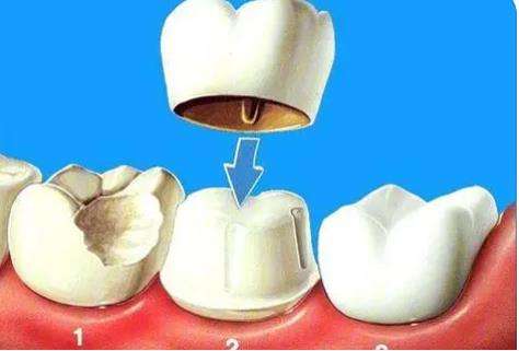 http://www.rmcbs.cn/d/file/price/87cfiqtaavyp.jpg