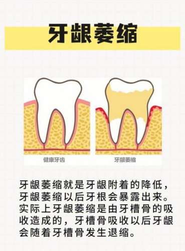 http://www.rmcbs.cn/d/file/price/8q6tw4w5ryu1.jpg