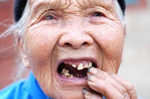 優(yōu)伢仕口腔醫(yī)院收費指南：2024最新價格表