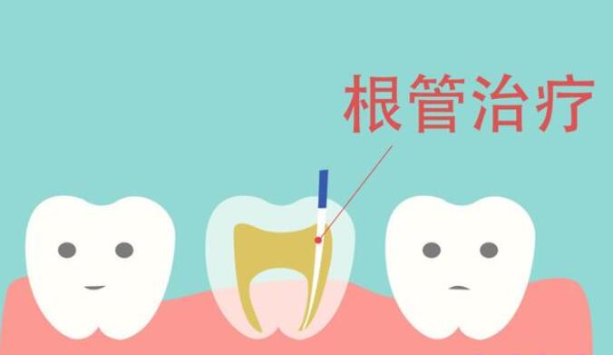 http://www.rmcbs.cn/d/file/price/IEGOBCLII9.jpg