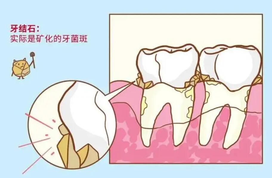 http://www.rmcbs.cn/d/file/price/WBM0CUSI4A.jpg
