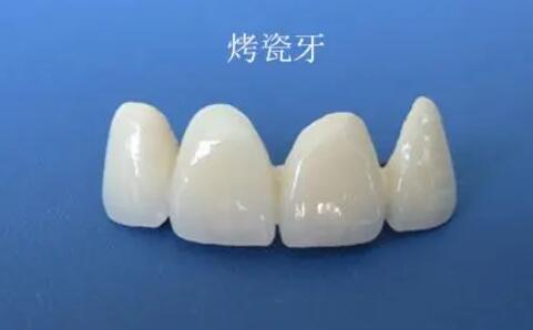 http://www.rmcbs.cn/d/file/price/avyobiy1a0kv.jpg