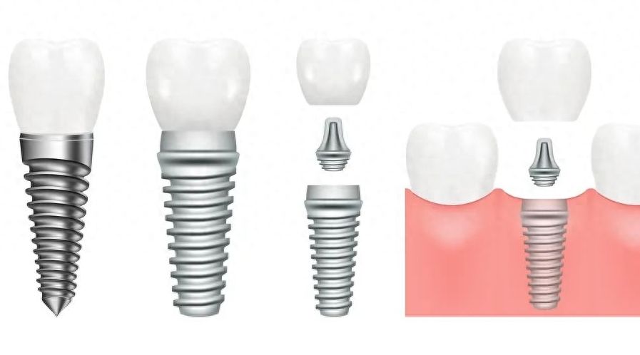http://www.rmcbs.cn/d/file/price/bwbf40hho1q3.jpg