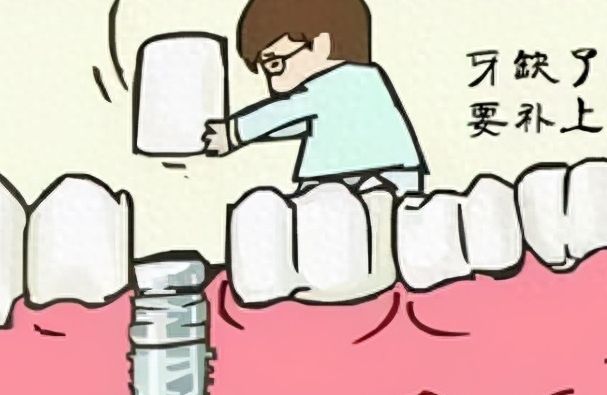 2024種植牙醫(yī)院推薦：精選全國5家公立?？漆t(yī)院+價格表