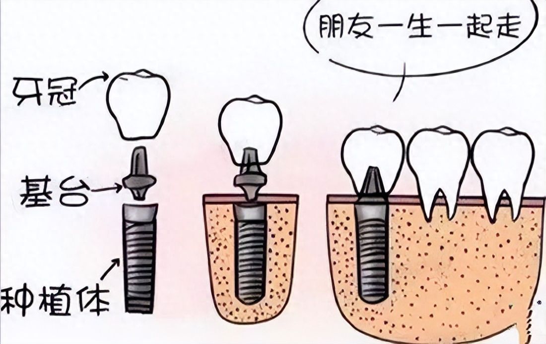 http://www.rmcbs.cn/d/file/price/c42yl087kfn0.jpg