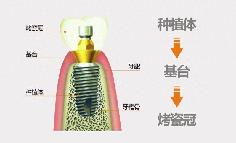 http://www.rmcbs.cn/d/file/price/c5550ip5cel2.jpg
