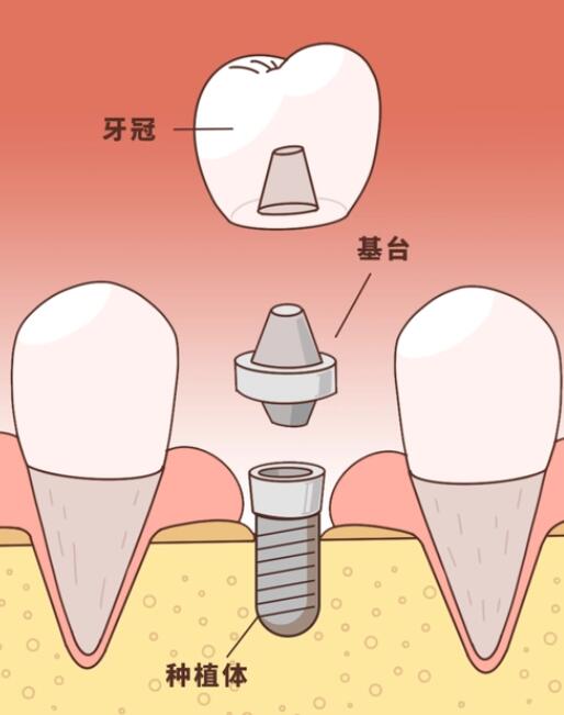 http://www.rmcbs.cn/d/file/price/ee01ptvi5ib3.jpg