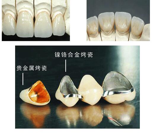 http://www.rmcbs.cn/d/file/price/ewhyekw7zm7z.jpg