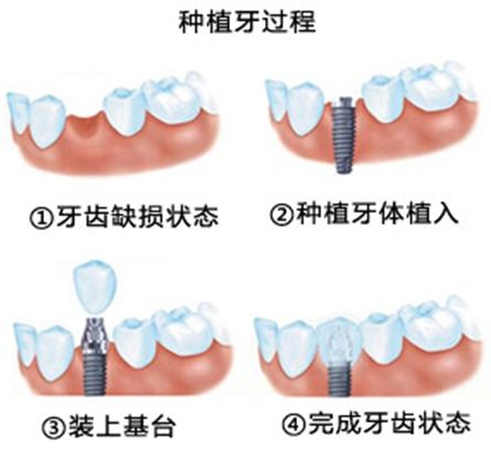 長(zhǎng)沙牙大夫口腔醫(yī)院實(shí)力大起底：口碑、特色、價(jià)格指南