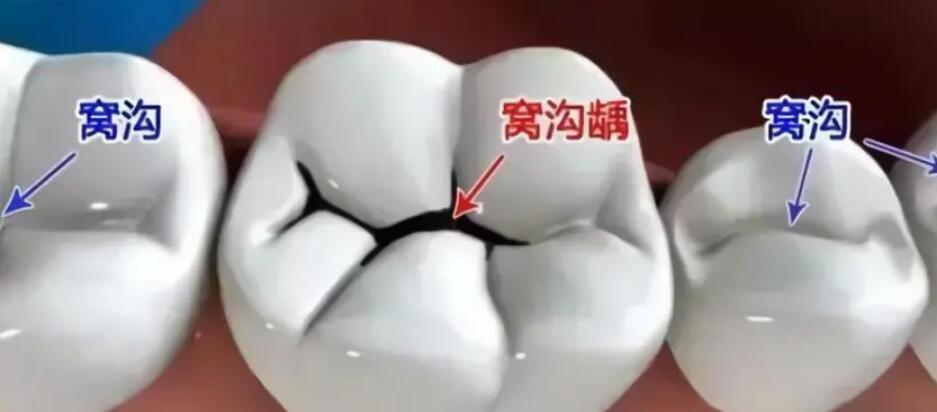 http://www.rmcbs.cn/d/file/price/gkpcm6h2b2.jpg