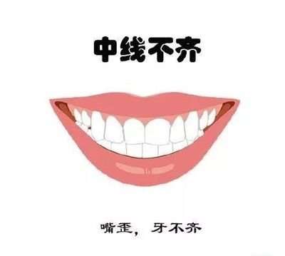 西寧牙齒矯正費(fèi)用一覽，隱形矯正價(jià)格參考指南
