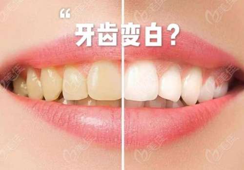 http://www.rmcbs.cn/d/file/price/hchvdyandaok.jpg