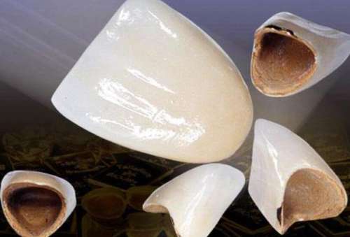 2024年種植牙費(fèi)用趨勢(shì)預(yù)測(cè)