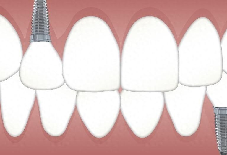http://www.rmcbs.cn/d/file/price/k3fe9czpvchz.jpg