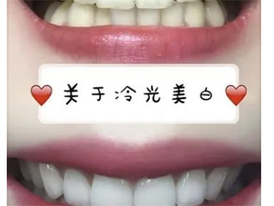 http://www.rmcbs.cn/d/file/price/lf1gjl3h666a.jpg