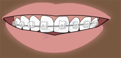 http://www.rmcbs.cn/d/file/price/lmnudzr0zs.jpg