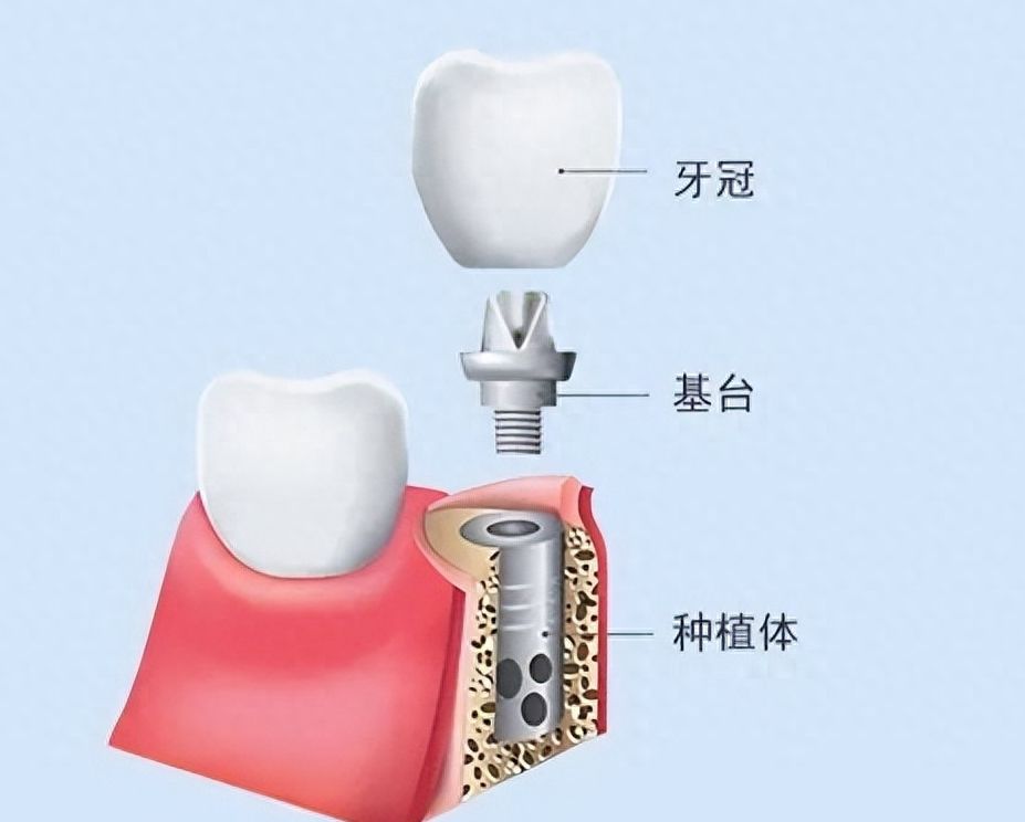 http://www.rmcbs.cn/d/file/price/mawaljf8sgv4.jpg