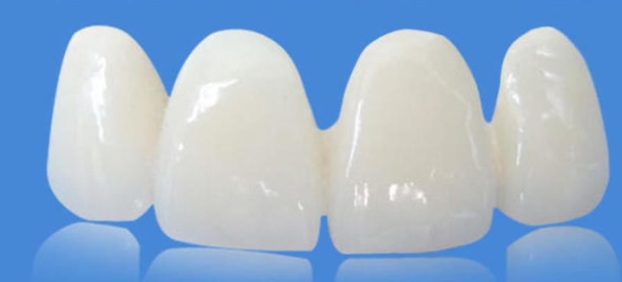 http://www.rmcbs.cn/d/file/price/mfwwzoekug83.jpg
