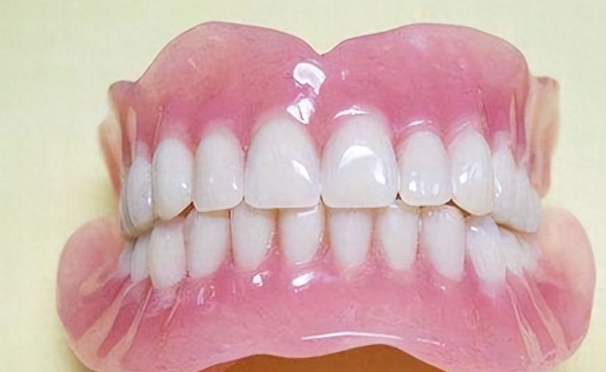 南通美奧口腔戴鋼牙套真實(shí)體驗(yàn)：費(fèi)用實(shí)惠效果棒