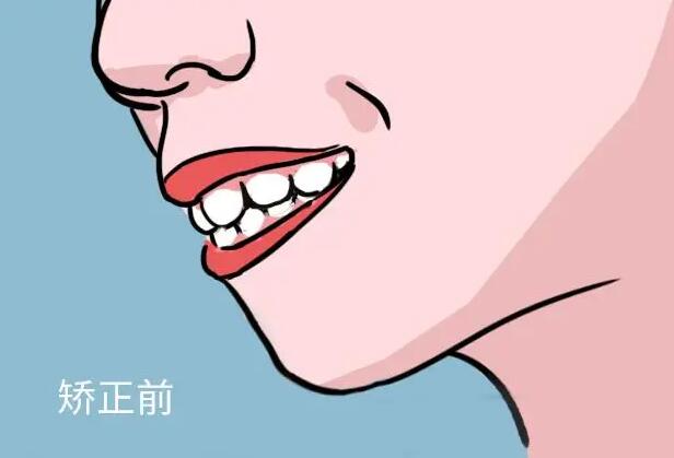 http://www.rmcbs.cn/d/file/price/mit1xlfhom.jpg