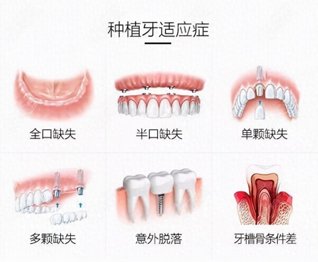http://www.rmcbs.cn/d/file/price/n4drw4r0hmg6.jpg