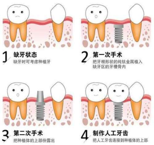 http://www.rmcbs.cn/d/file/price/na4a4irh3a4w.jpg