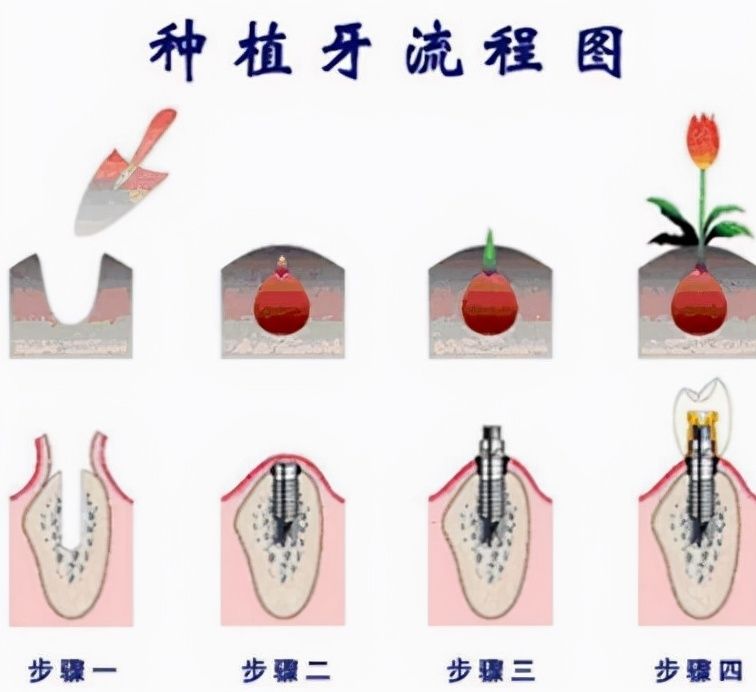 http://www.rmcbs.cn/d/file/price/nbyvvwij846e.jpg