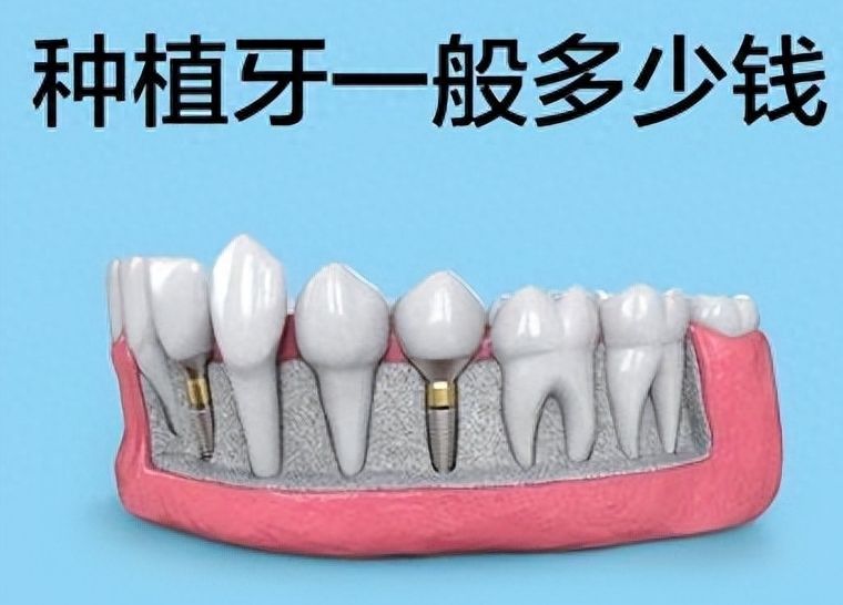 http://www.rmcbs.cn/d/file/price/nus4fh093zpb.jpg