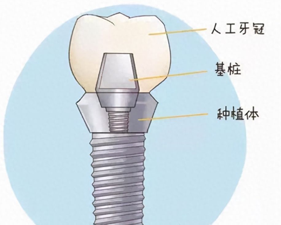 http://www.rmcbs.cn/d/file/price/nzt4vncwv2l4.jpg
