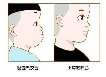 佛山口腔醫(yī)院種植牙價(jià)格指南：全口單顆費(fèi)用詳解
