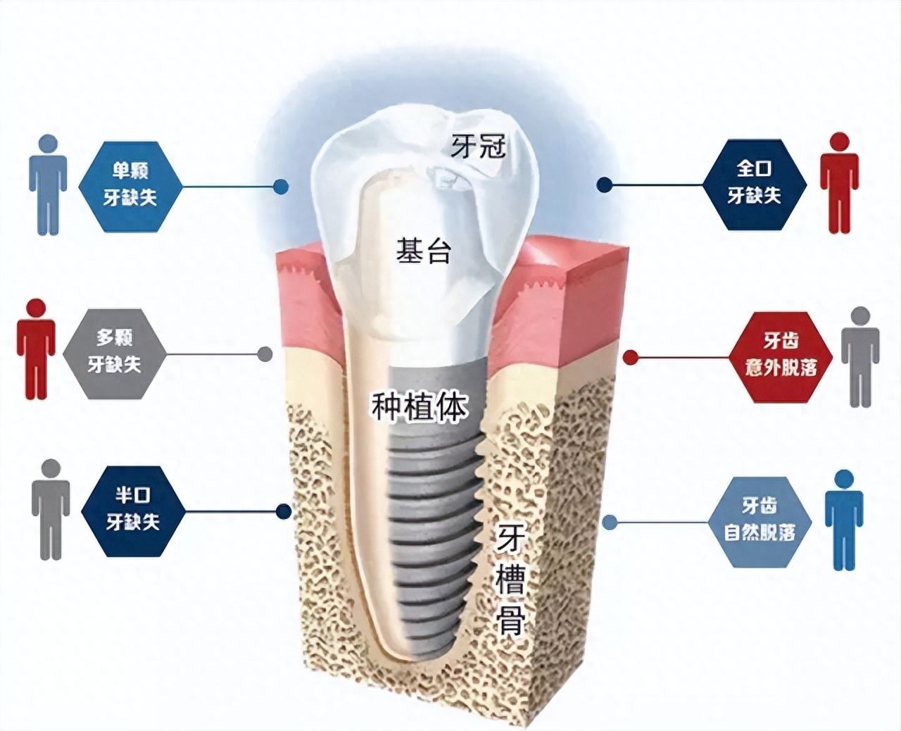 http://www.rmcbs.cn/d/file/price/oaofrp49xupx.jpg