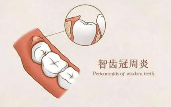 http://www.rmcbs.cn/d/file/price/phjzqfbzliss.jpg
