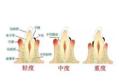 http://www.rmcbs.cn/d/file/price/poetbeq0hegc.jpg