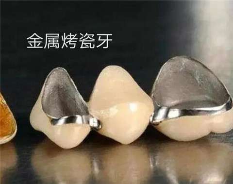 http://www.rmcbs.cn/d/file/price/qnfneszrxbq9.jpg