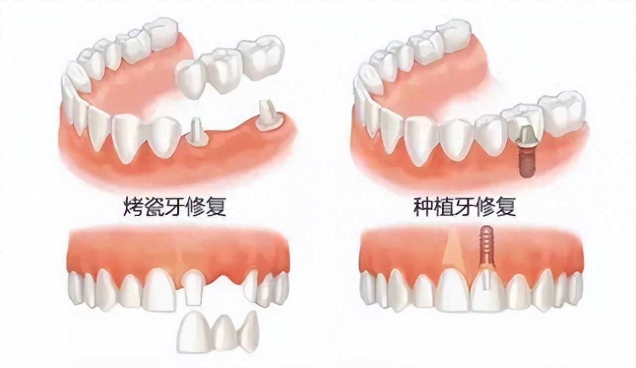 http://www.rmcbs.cn/d/file/price/qpd7j8t4808s.jpg