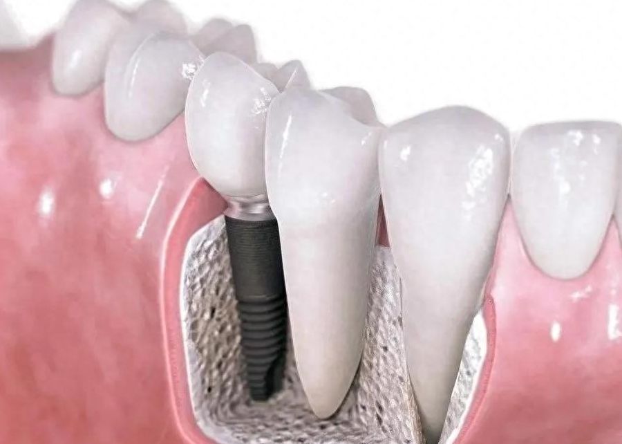 http://www.rmcbs.cn/d/file/price/r6gv92tbsh5l.jpg