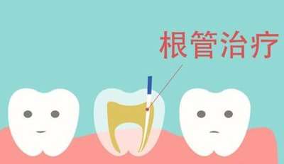 詳解：氧化鋁全瓷牙與二氧化鋯全瓷牙，一顆多少錢(qián)？