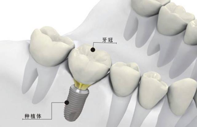http://www.rmcbs.cn/d/file/price/tej2cd9ik4.jpg