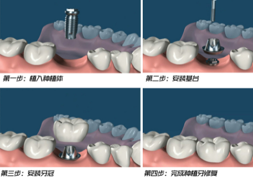 http://www.rmcbs.cn/d/file/price/uny86wl661fk.jpg