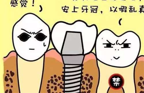 鈷鉻合金烤瓷牙的優(yōu)缺點(diǎn)和價(jià)格分析