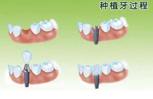 http://www.rmcbs.cn/d/file/price/vhn5532i6a4t.jpg